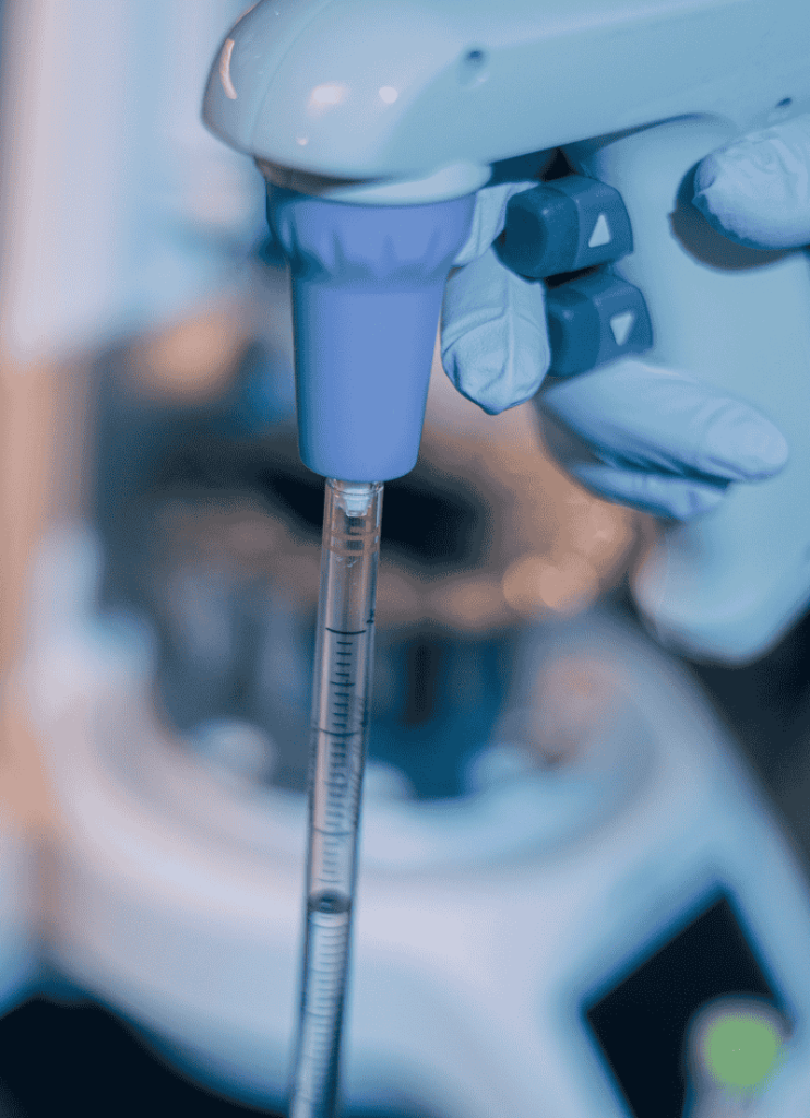 Exosomes analysis