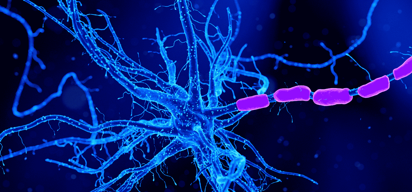 Exosomes as Promising Biomarkers in Early Detection of Neurodegenerative Diseases