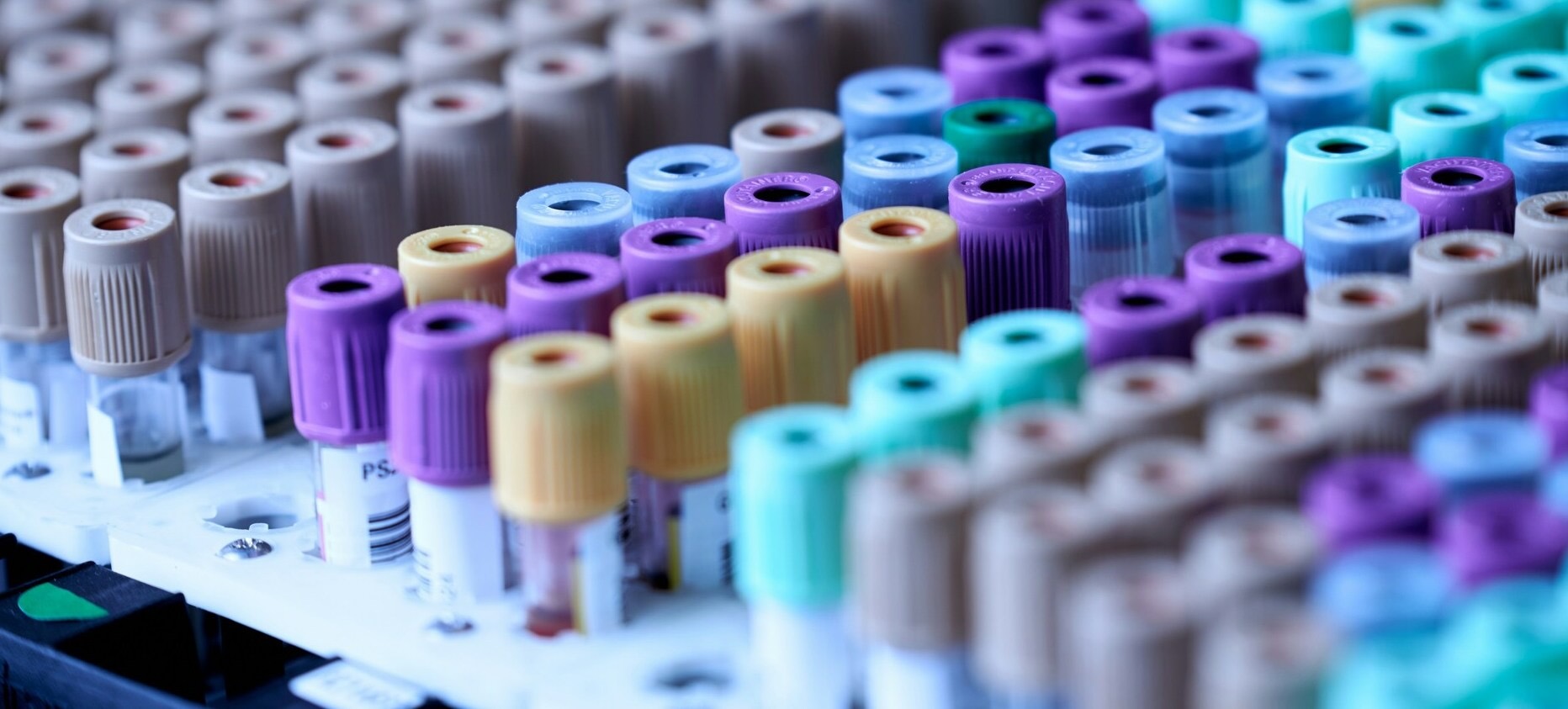 Plasma biomarker assay development and clinical sample processing.